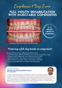 Full Mouth Rehabilitation with Injectable Composites